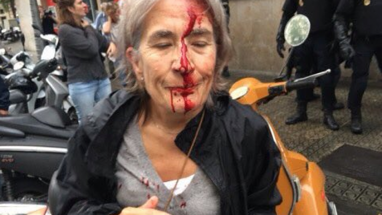 Përgjaket referendumi në Kataloni, policia gjuan me plumba gome votuesit (Foto)