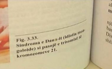 Skandaloze: Në librat e biologjisë në Kosovë, personi me sindromën Down cilësohet ‘idiot mongoloid’ që nuk jeton më shumë se 15 vite!