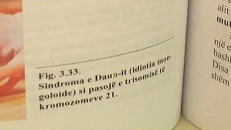 Skandaloze: Në librat e biologjisë në Kosovë, personi me sindromën Down cilësohet ‘idiot mongoloid’ që nuk jeton më shumë se 15 vite!