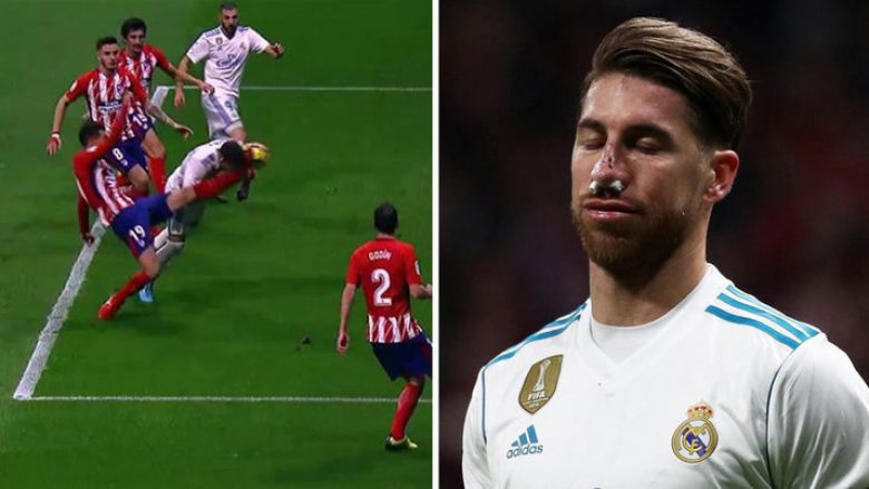 Momenti kur lojtari i Atleticos ia theu hundën Ramosit, Zidane nuk e di nëse kapiteni do të luajë ndaj Apoelit (Video)