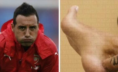 Dëmtimi që për pak e la Cazorlan pa një këmbë - Mund të mos luajë më kurrë futboll, por ai beson që do të rikthehet (Foto)