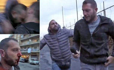 Arrestohet sulmuesi i cili i theu hundën gazetarit dhe pastaj e sulmoi me një gyp metali (Video)