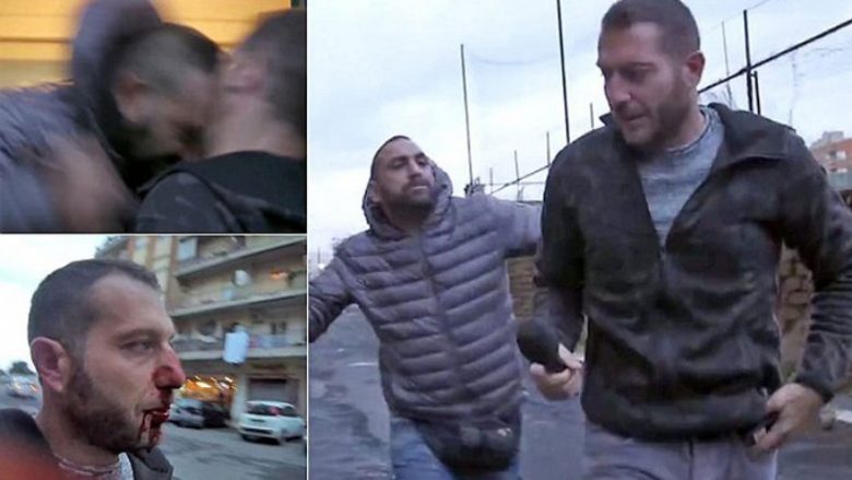 Arrestohet sulmuesi i cili i theu hundën gazetarit dhe pastaj e sulmoi me një gyp metali (Video)