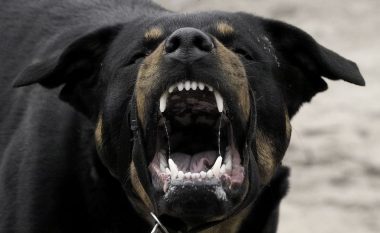 Reagime për kafshimin nga qeni të gjashtë personave në Shkup, publikohen fotot e një të lënduare (Foto)