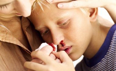 Përse fëmijëve u rrjedh gjak nga hundët