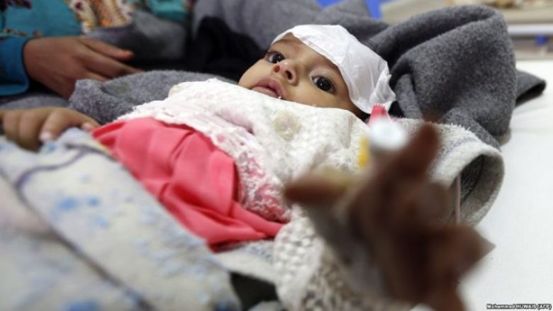 Një milion persona në Jemen dyshohet se janë të prekur nga kolera