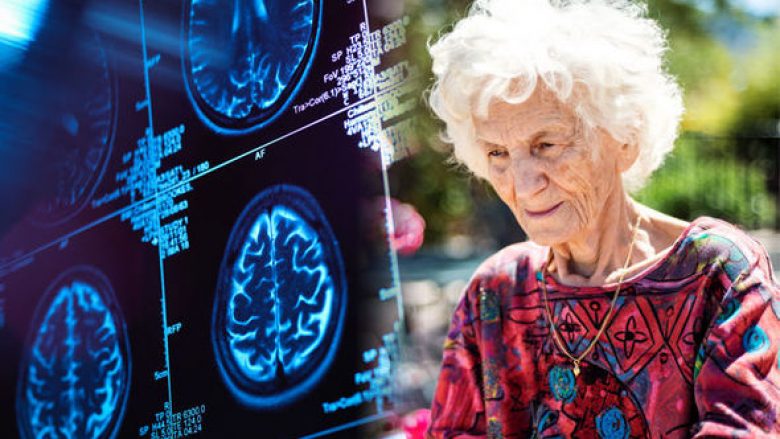 Parandalimi i demencës: Shmangni këto pesë ushqime për ta zvogëluar rrezikun e sëmundjes së Alzheimerit