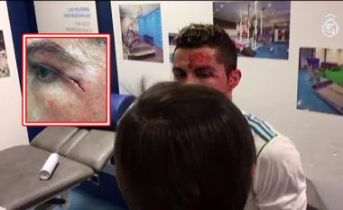 Publikohet video teksa Ronaldo mjekohej nga lëndimi në zhveshtore, qarja ishte shumë afër syrit (Foto)