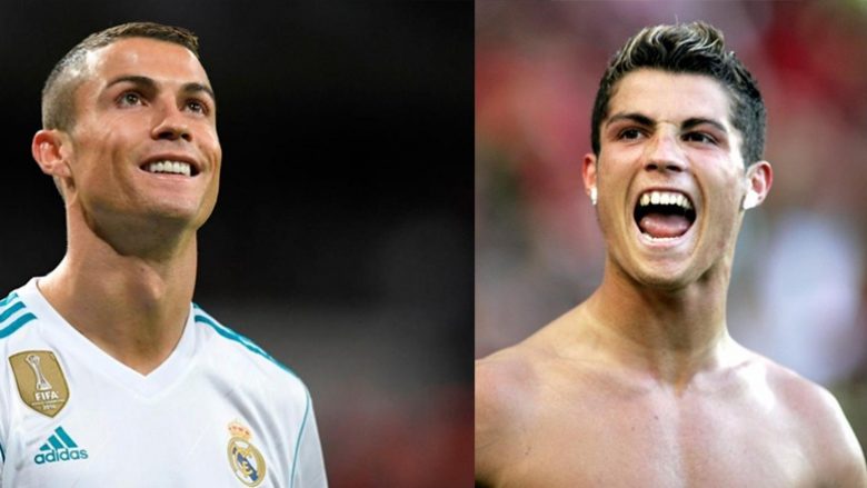 Yjet e futbollit, para dhe pas vizitës tek dentisti (Foto)