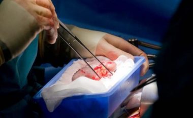 Gjermania vuan mungesën e dhurimit të organeve, kërkojnë zgjidhje tek shkëmbimi i organeve me vende të tjera