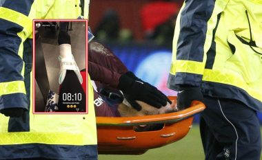 Neymar publikon një fotografi të këmbës së lënduar