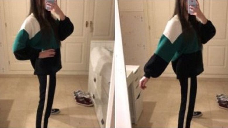 Këmbët e pazakonta të adoleshentes, fotografia bëhet virale menjëherë (Foto)