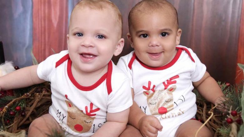 Një i bardhë dhe një me ngjyrë: Luca dhe Levi binjakët nga Australia (Foto)