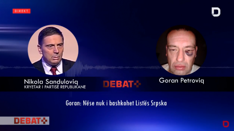 Petroviq: Oliver Ivanoviq u kërcënua nga Vuçiq se do të vritej, nëse nuk i bashkohet Listës Serbe (Video)