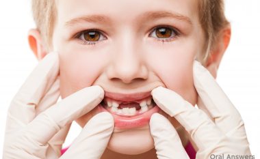 Nxjerrja e dhëmbëve të qumështit nuk shkakton dhimbje te fëmijët (Video + Foto )