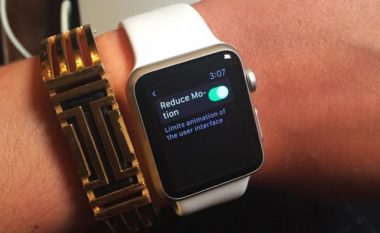 Apple Watch shpëton jetën e një 25-vjeçarje