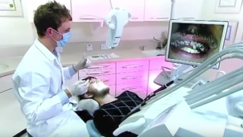Ky burrë nuk i lau dhëmbët për 20 vjet, tani dentisti ia ka kthyer buzëqeshjen (Video)