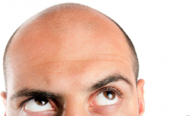Një hap më afër drejt zbulimit të ilaçit kundër rënies së flokëve
