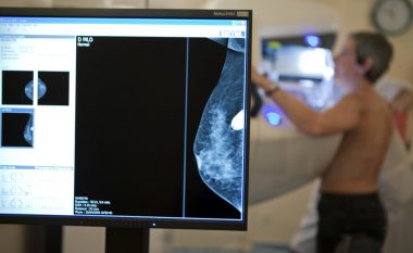 Gabimet e mamografive quan në vdekjen e 270 grave