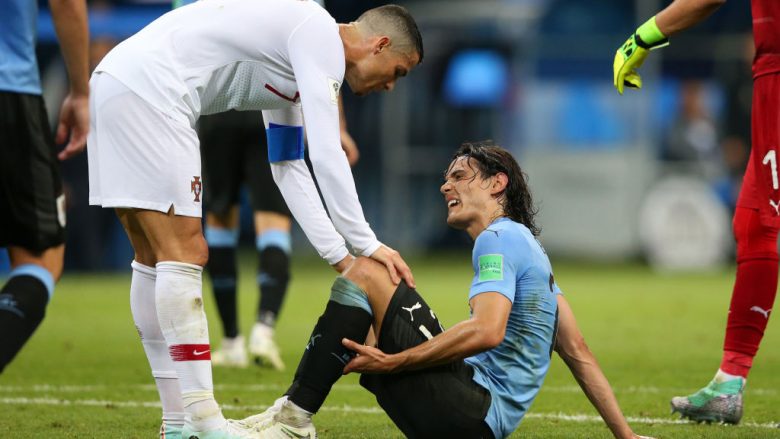 Mjekët e Kombëtares së Uruguait: Cavani nuk ka këputje të muskulit, do të jetë në fushë me Francën