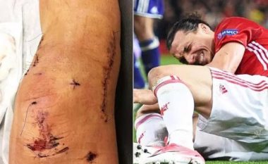 Ibrahimovic zbulon foton nga lëndimi që kishte dhe fjalët e mjekëve për ta mbyllur karrierën: Ata thanë se përfundoi, unë thashë jo