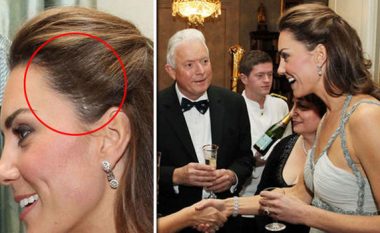Kate Middleton ka një shenjë të ndërhyrjes kirurgjike në kokë që e ka fshehur mjeshtërisht për shumë vite