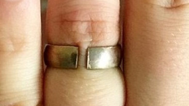 Unazën e martesës që e bleu si të ‘çmuar dhe me 18 karat’, iu shkëput pasi ishte metal pa vlerë (Foto)