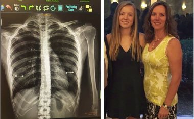 Nëna zbulon vathët e fshehtë të bijës falë radiografisë