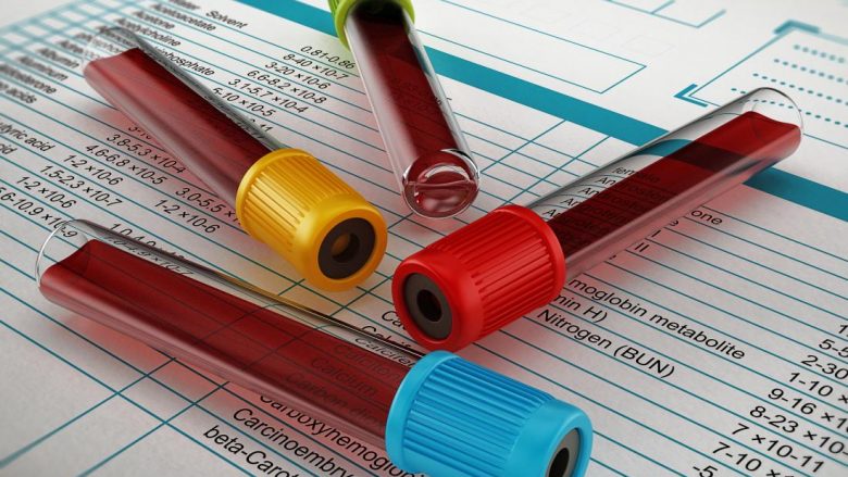 Rregullat para se të jepni gjakun për analiza, të cilat shumica nuk i dinë – për këtë shkak rezultatet shpesh nuk janë valide!