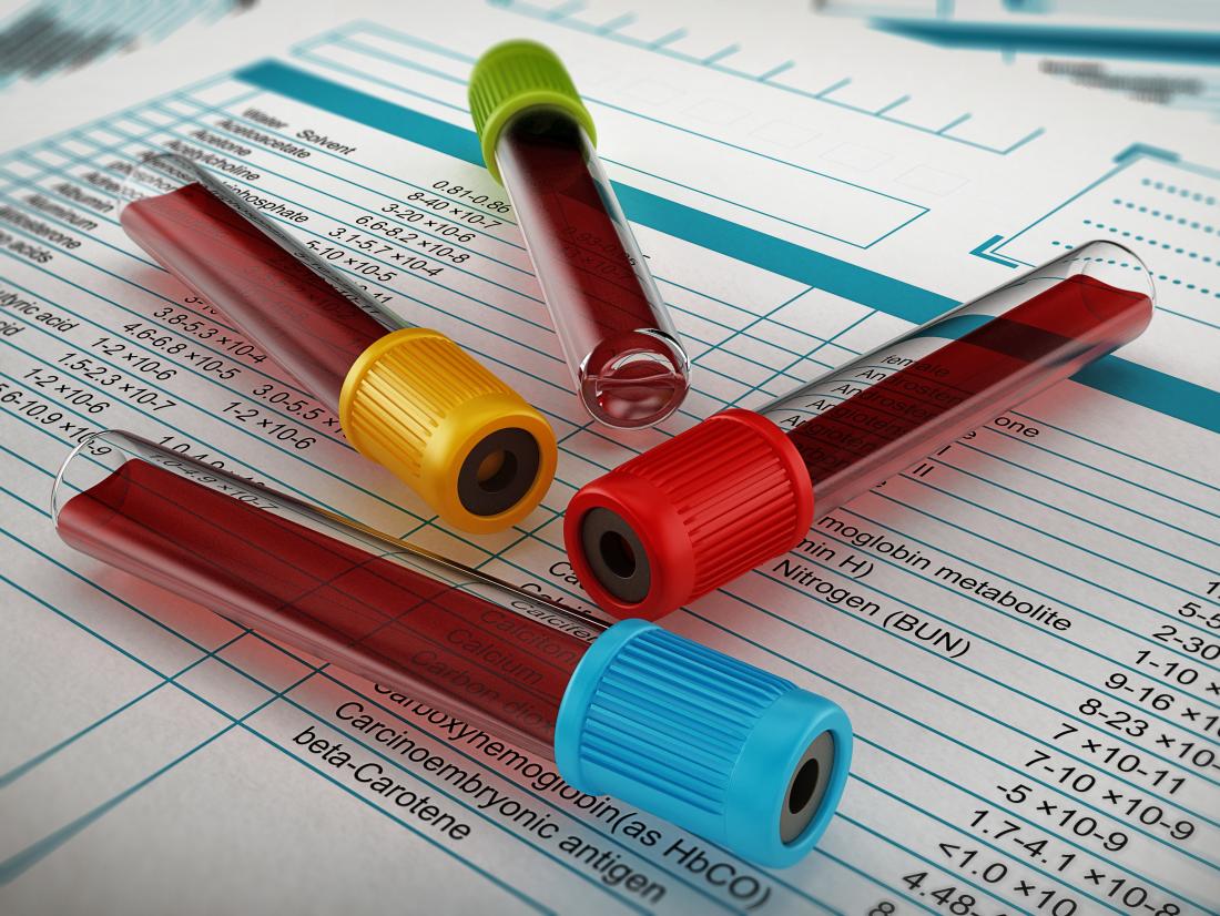 Rregullat para se të jepni gjakun për analiza, të cilat shumica nuk i dinë – për këtë shkak rezultatet shpesh nuk janë valide!