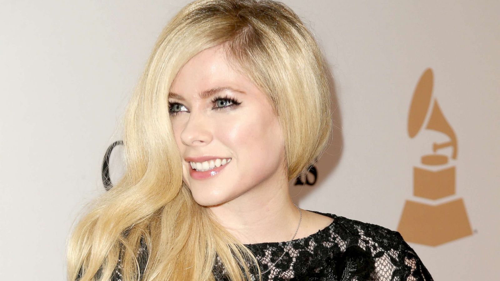 Avril Lavigne: Gjatë betejës me sëmundjen, shtiresha se jam mirë duke sjell imazhe të lumtura në Instagram