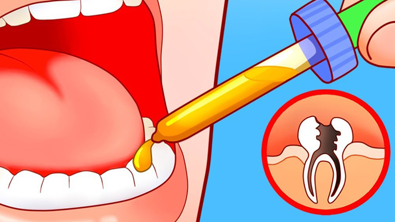 Tetë mënyra efektive për të ndaluar dhimbjen e dhëmbit në kushte shtëpie