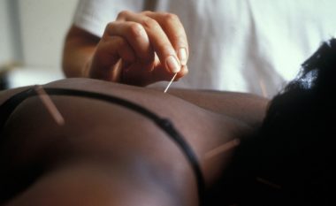 A mundet akupunktura t’ju ndihmojë të mbetni shtatzënë?