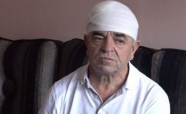 Dënohet me dy vjet burg njëri nga sulmuesit e Sokol Zogajt