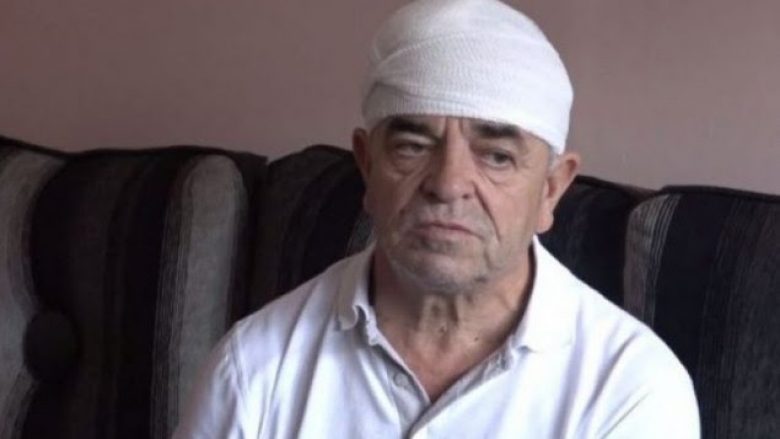 Dënohet me dy vjet burg njëri nga sulmuesit e Sokol Zogajt