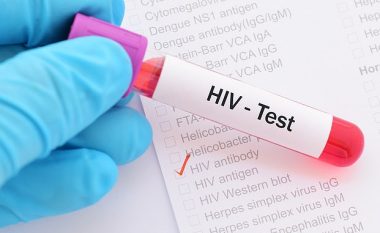 Shpresë për miliona njerëz – shkencëtarët shumë afër ilaçit që e shëron HIV-in