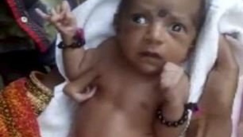 Fëmijës, që lindi me tri duar, po i falen në Indi sikur të jetë hyjni (Foto)