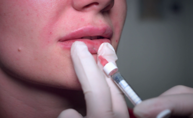 Vaksina e Moderna mund të shkaktojë efekte anësore te njerëzit me mbushës kozmetikë në fytyrë