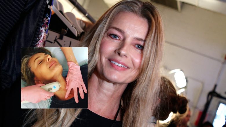 Modelja Paulina Porizkova tregon për ‘ulterapinë’ që e shfrytëzon për dukjen rinore