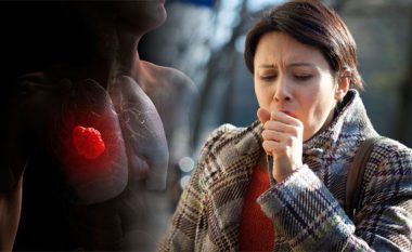 Tuberkulozi i rrezikshëm: Një i sëmurë mund të infektojë 15 persona
