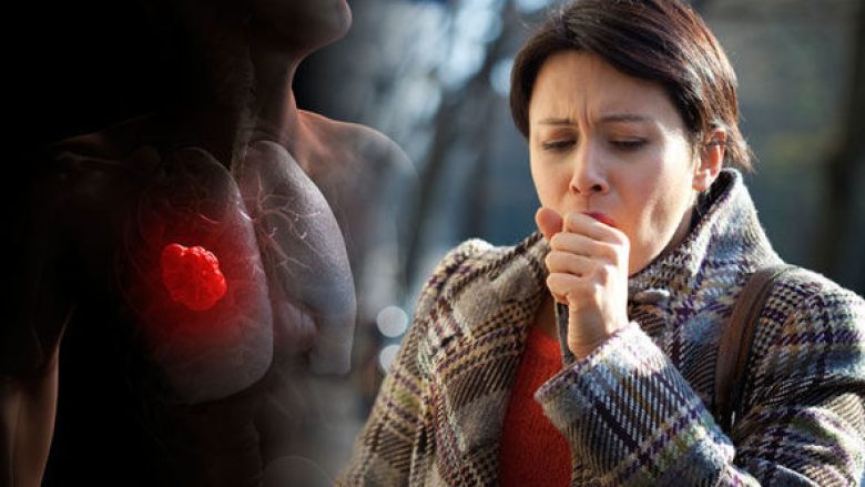Tuberkulozi i rrezikshëm: Një i sëmurë mund të infektojë 15 persona