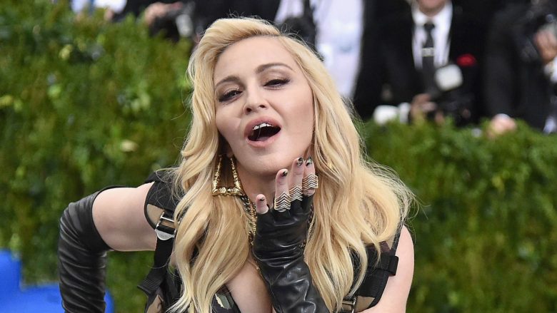 Nga Kate Moss te Madonna: Figura të njohura me dhëmbë të çrregullt dhe krenarë