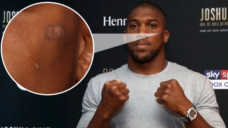 Anthony Joshua shfaqet me një lëndim në fytyrë para meçit me Andy Ruizin – nuk e pranon që është lënduar në sparing