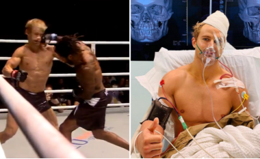 Ylli i MMA, Sage Northcutt u nokautua për 29 sekonda – për shkak të lëndimeve të rënda operacioni zgjati nëntë orë
