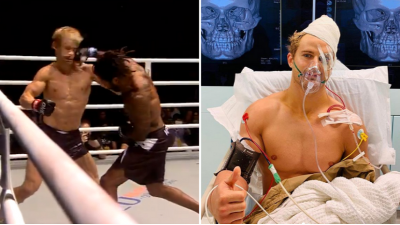 Ylli i MMA, Sage Northcutt u nokautua për 29 sekonda – për shkak të lëndimeve të rënda operacioni zgjati nëntë orë