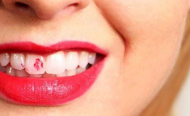 Tri mënyra të thjeshta që dhëmbët të shpëtojnë nga shenjat e buzëkuqit