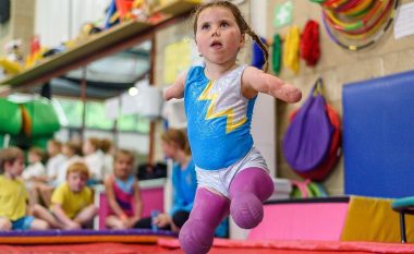 Si njëvjeçare humbi duart dhe këmbët nga meningjiti, sot ajo merret me gjimnastikë (Foto/Video)