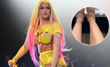 Cardi B tregon gjendjen e mjerueshme të këmbëve të saj, teksa tenton të shërohet nga kirurgjia plastike