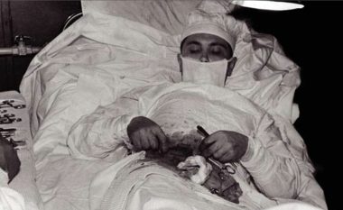 Historia e jashtëzakonshme e kirurgut që operoi veten nga zorra qorre