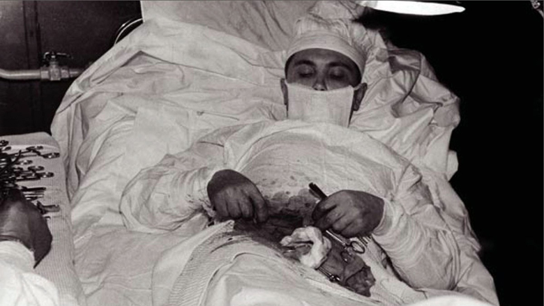 Historia e jashtëzakonshme e kirurgut që operoi veten nga zorra qorre